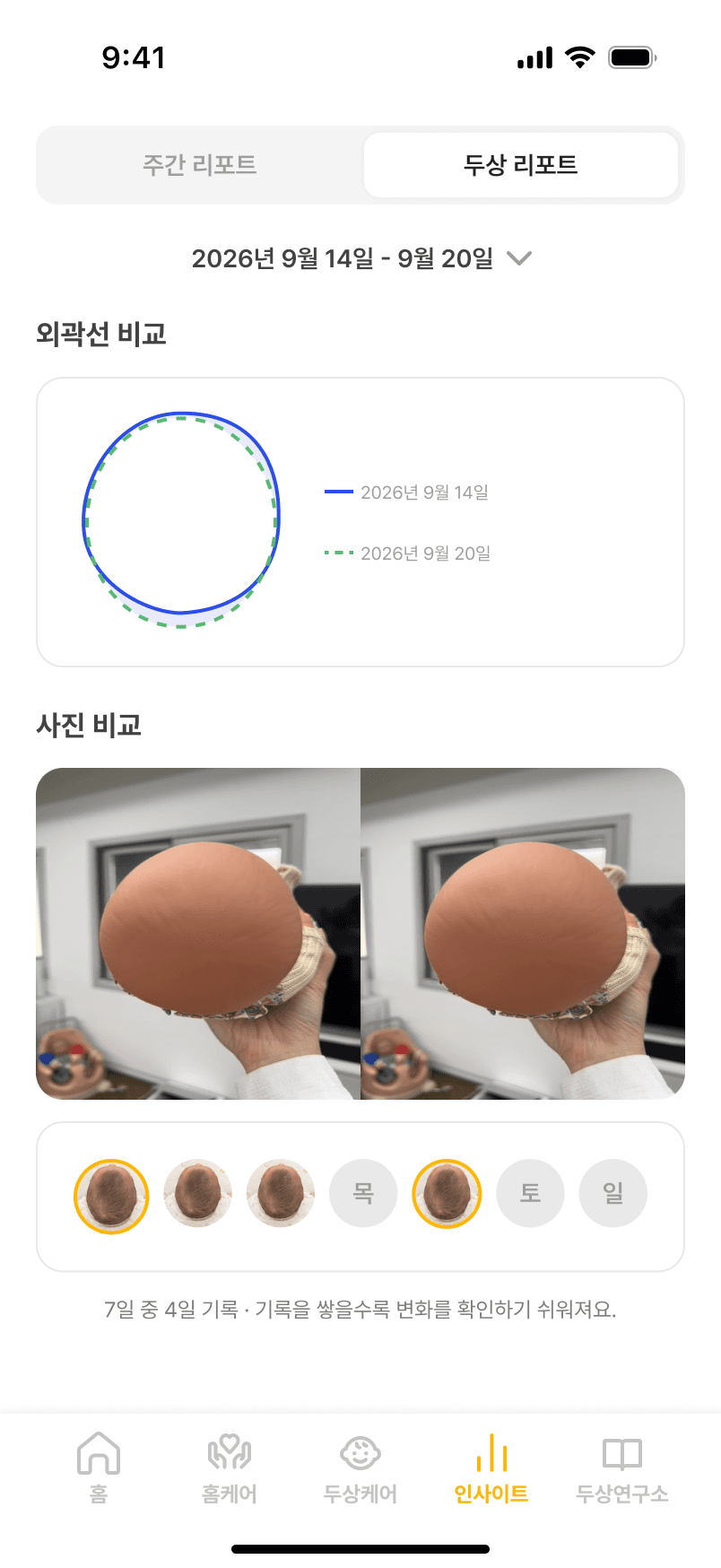 Barodori head shape report, outline and photo comparison